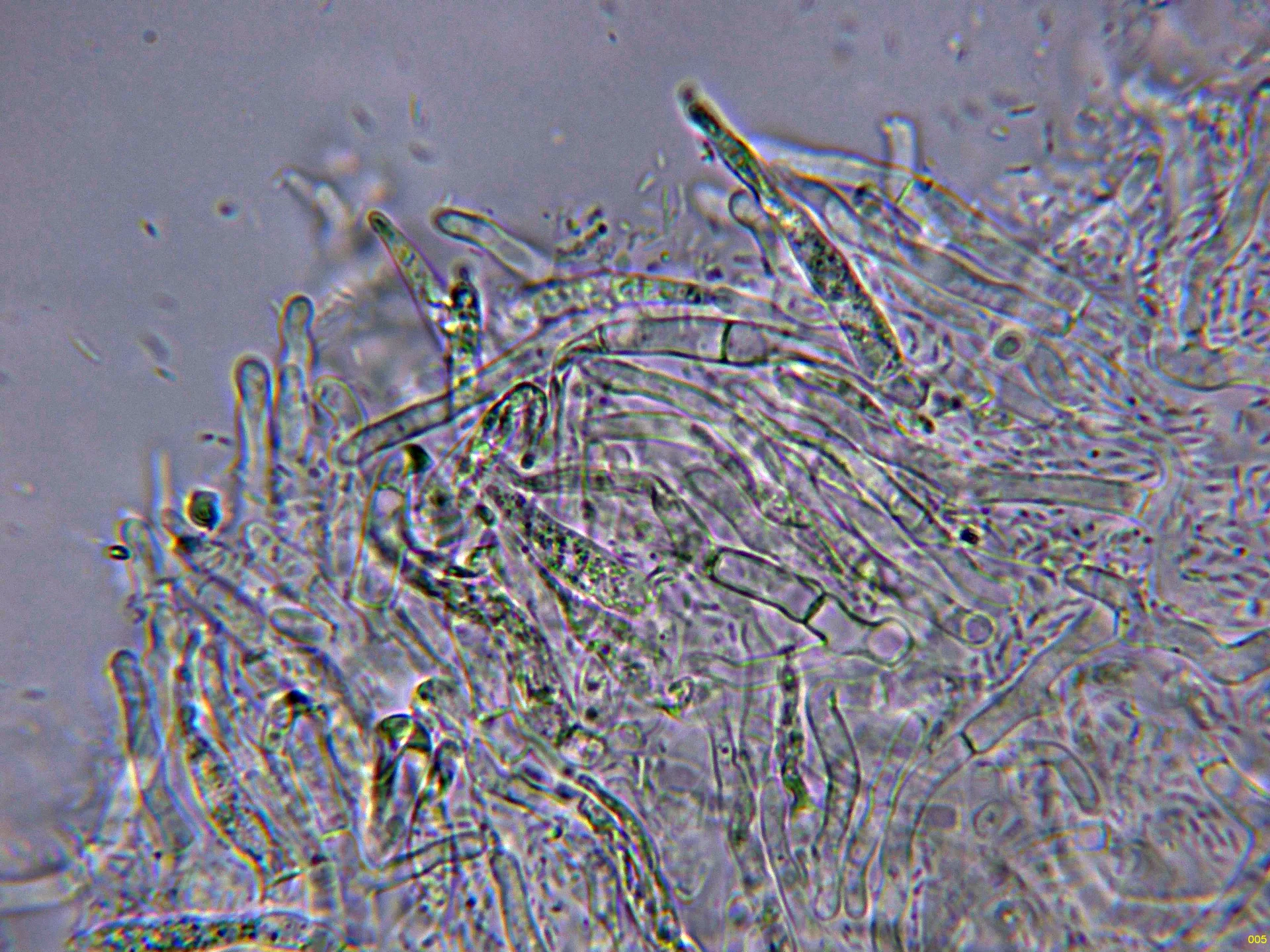 Microscopía de Russula pectinatoides - 10 - Dermatocistidio agua-005